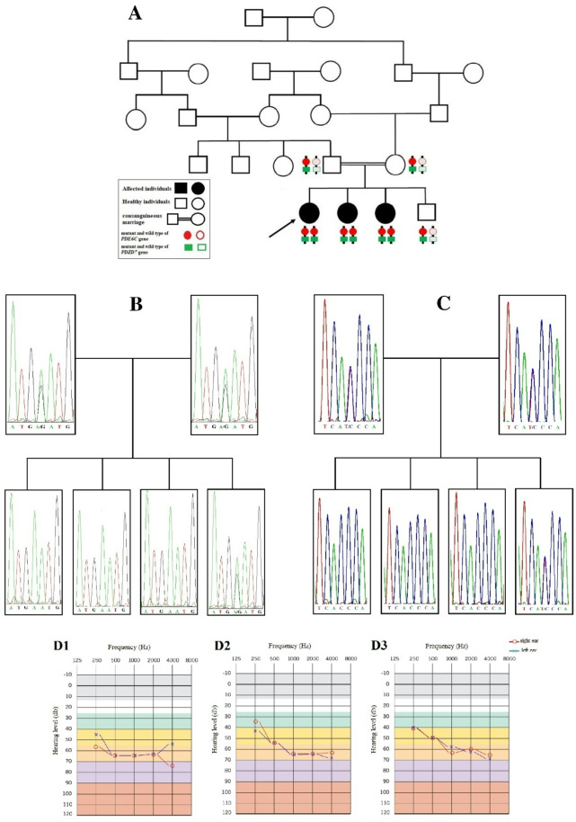 Correction: Clinical characterizations and molecular genetic study of two co-segregating variants in PDZD7 and PDE6C genes leading simultaneously to non-syndromic hearing loss and achromatopsia.
