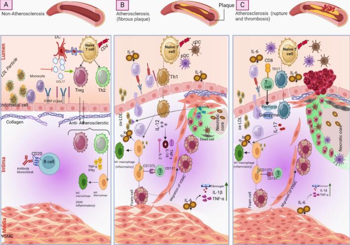 Mitigating atherosclerosis: Integrating vaccines with gene targets.