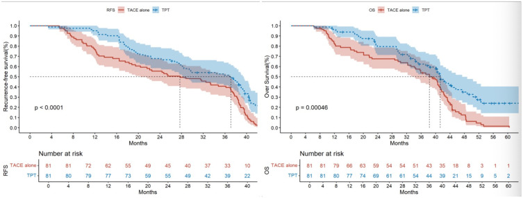 Whether Adjuvant TACE Plus TKI Therapy is More Effective Than TACE Alone in HCC Patients at High Risks of Recurrence Following Radical Hepatectomy.