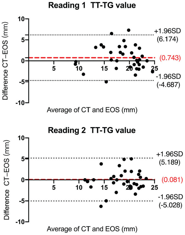 Reliability and Reproducibility of the EOS 3D Imaging System in Measuring TT-TG Distance in Patients With Recurrent Patellar Dislocation.