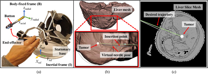 Experimental evaluation of virtual needle insertion framework with enhanced haptic feedback.