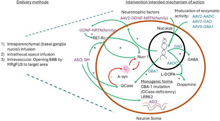 Investigational Gene Therapies for Parkinson's Disease.
