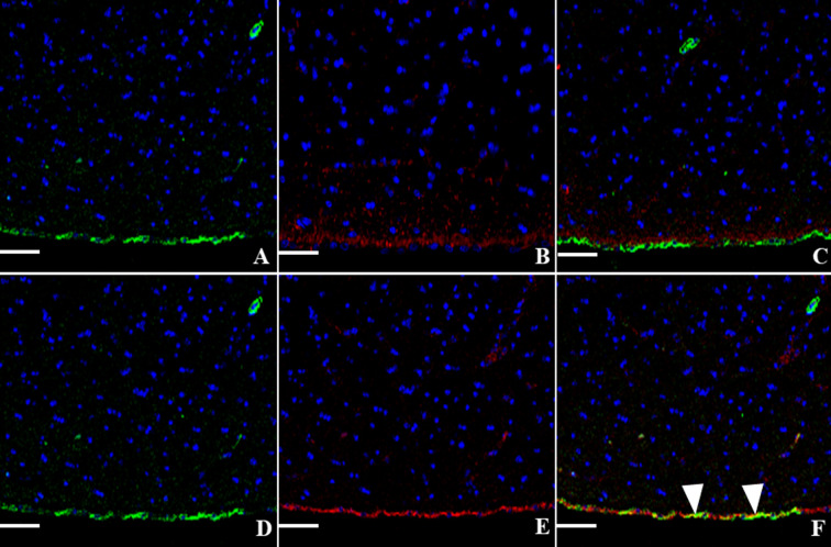 Expression of α-smooth muscle actin in the lateral ventricle wall of spontaneous hydrocephalus animals.