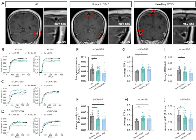 Meningeal lymphatic dysfunction in sporadic cerebral small vessel diseases and cerebral autosomal dominant arteriopathy with subcortical infarcts and leukoencephalopathy by DCE-MRI.