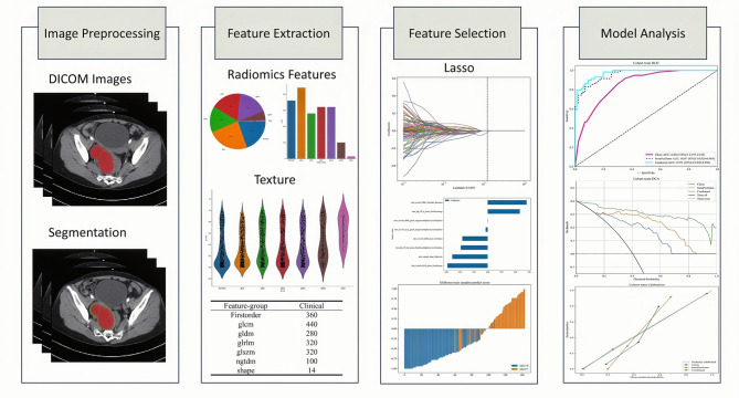 Predicting preoperative lymph node metastasis in patients with high-grade serous ovarian cancer by using intratumoral and peritumoral radiomics: a retrospective cohort study.