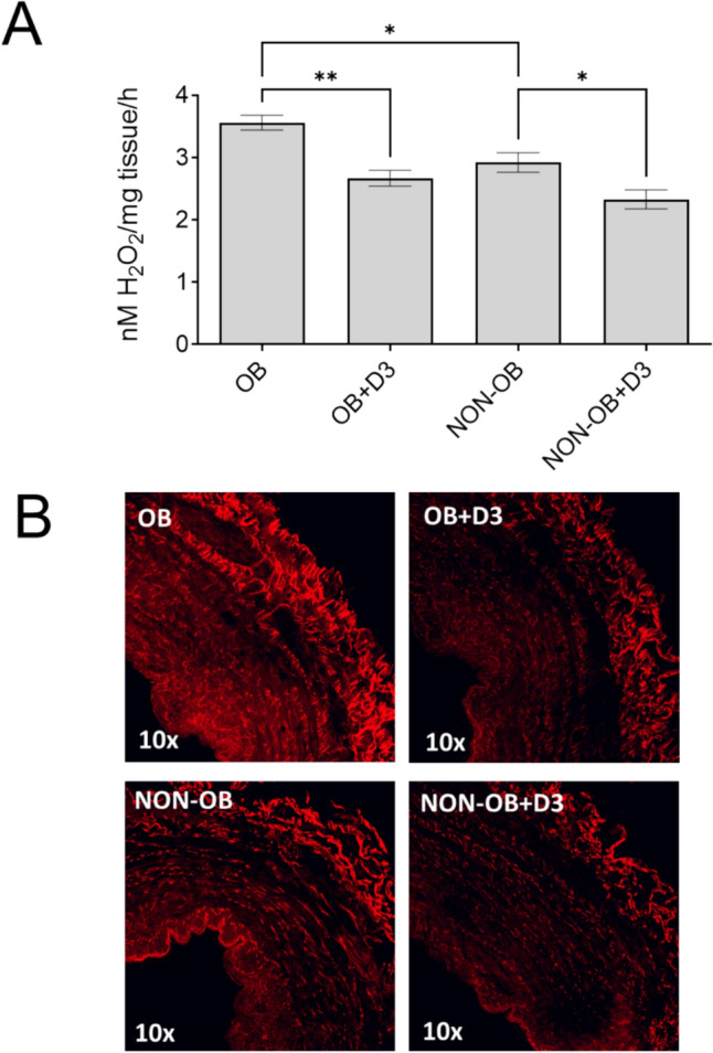 Vitamin D alleviates oxidative stress in varicose veins: a pilot study in obese and non-obese patients.