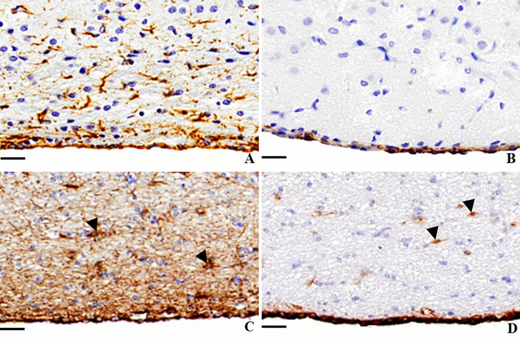Expression of α-smooth muscle actin in the lateral ventricle wall of spontaneous hydrocephalus animals.