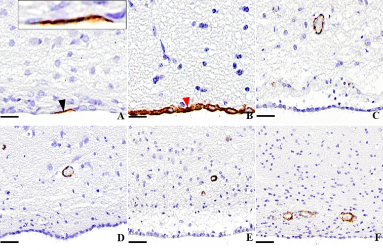 Expression of α-smooth muscle actin in the lateral ventricle wall of spontaneous hydrocephalus animals.