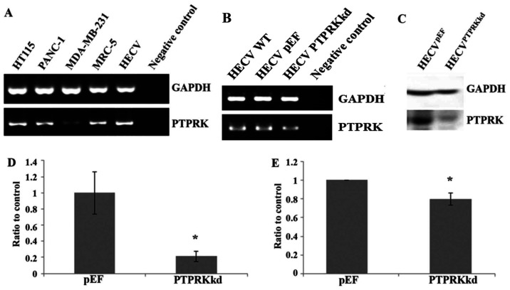 [Corrigendum] Dual roles of protein tyrosine phosphatase kappa in coordinating angiogenesis induced by pro-angiogenic factors.