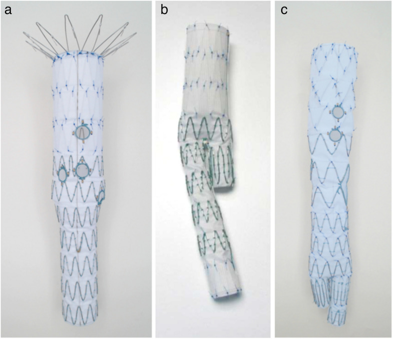 The use of combined fenestrated and bifurcated endografts in fenestrated aortic repair.