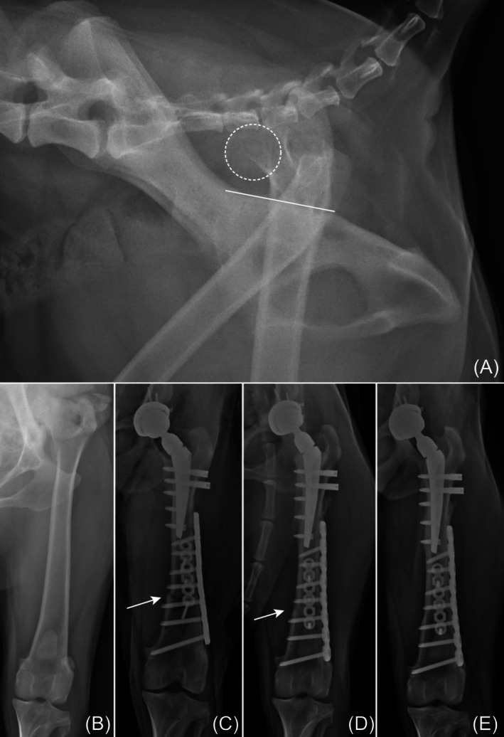 Distal femoral shortening osteotomy for managing irreducible hips during total hip replacement in four dogs with severe luxoid hips.