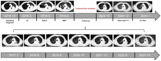 A Rare Case of Long-Term Survival in Stage IIIB Lung Adenocarcinoma: an 9-Year Follow-Up.