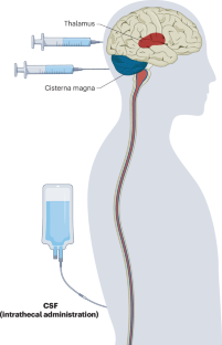 Location matters for brain gene therapy in lysosomal disorders