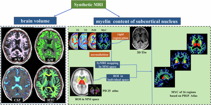 Synthetic MRI study of brain volume and subcortical myelin in various Parkinson’s disease motor subtypes