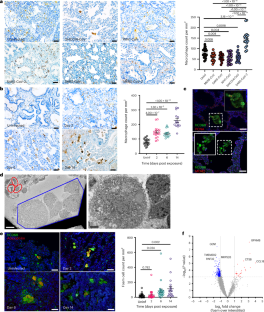 SARS-CoV-2 infection induces pro-fibrotic and pro-thrombotic foam cell formation