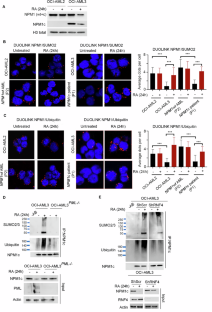 Retinoic acid disrupts an NPM1c/ROS/SENP3/ARF oncogenic axis in acute myeloid leukemia