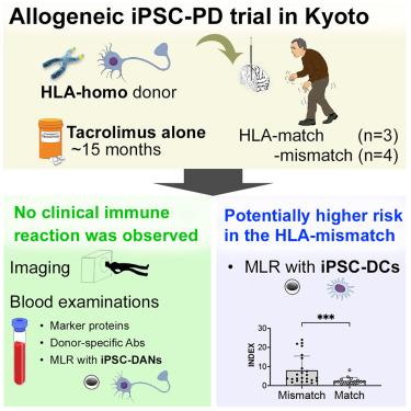 Control of immune response in an iPSC-based allogeneic cell therapy clinical trial for Parkinson’s disease