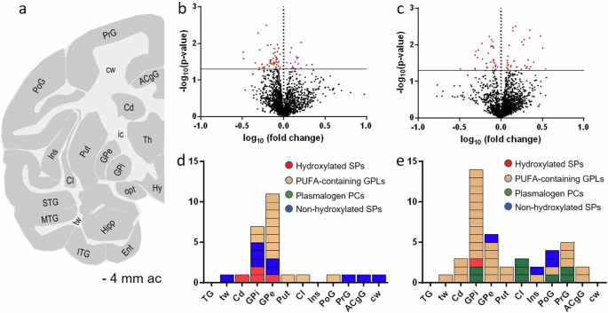 Brain-region-specific lipid dysregulation in L-DOPA-induced dyskinesia in a primate model of Parkinson’s disease