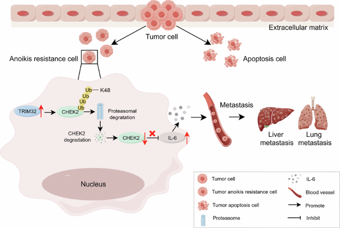 TRIM32 promotes anoikis resistance and metastasis in NSCLC by degrading CHEK2 to enhance IL-6 secretion.