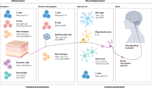 Pain in systemic lupus erythematosus: emerging insights and paradigms