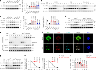 E3 ligase RAD18 targets phosphorylated IRF3 to terminate IFNB1 transcription