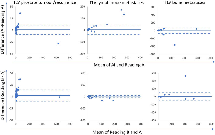 A fully automated AI-based method for tumour detection and quantification on [<sup>18</sup>F]PSMA-1007 PET-CT images in prostate cancer.