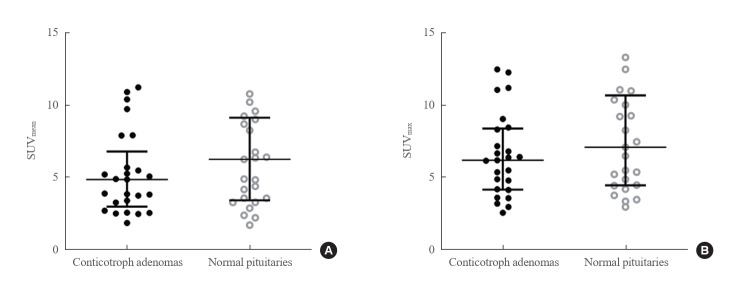 68Ga-DOTATOC PET/CT in the Localization of Pituitary Tumors in Cushing's Disease.