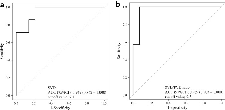 Splenic vein diameter/portal vein diameter ratio as a predictor of portal vein thrombosis after laparoscopic splenectomy in children.