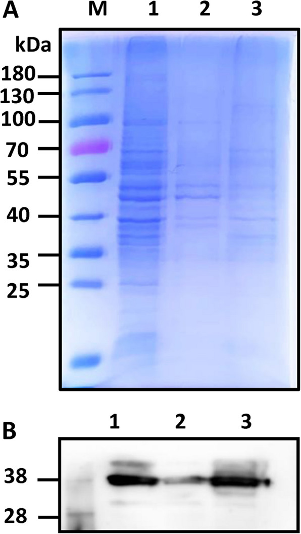 Role of P38 lipoprotein in Mycoplasma penetrans adhesion to human urothelial cells.