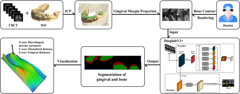 Clinical-oriented 3D visualization and quantitative analysis of gingival thickness using convolutional neural networks and CBCT.