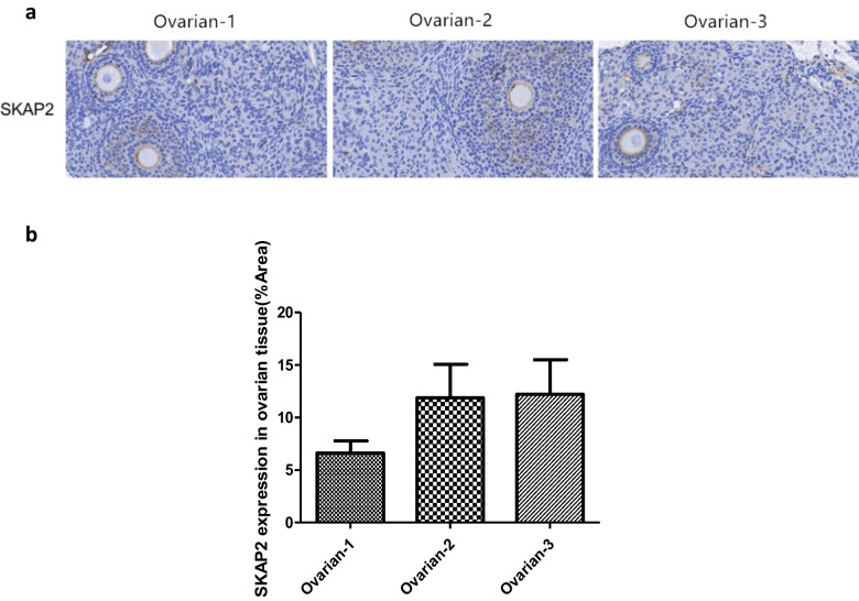 Expression and Regulatory Roles of SKAP2 and Cortactin in Mouse Ovarian Tissue and Oocyte Maturation.