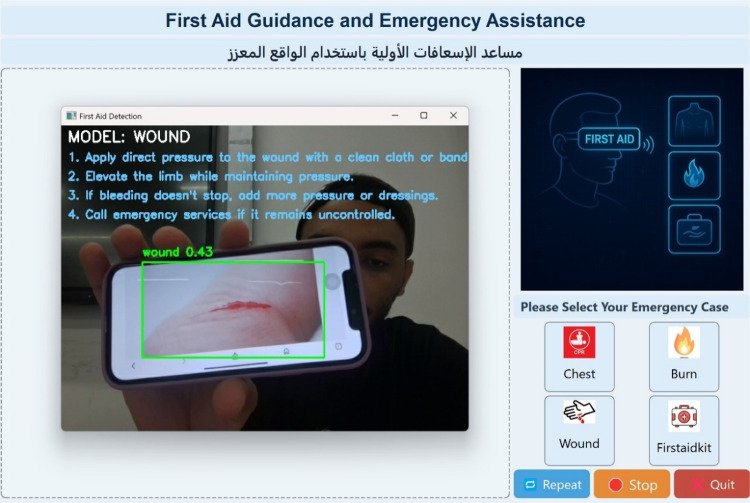 Development of an AI-powered AR glasses system for real-time first aid guidance in emergency situations.