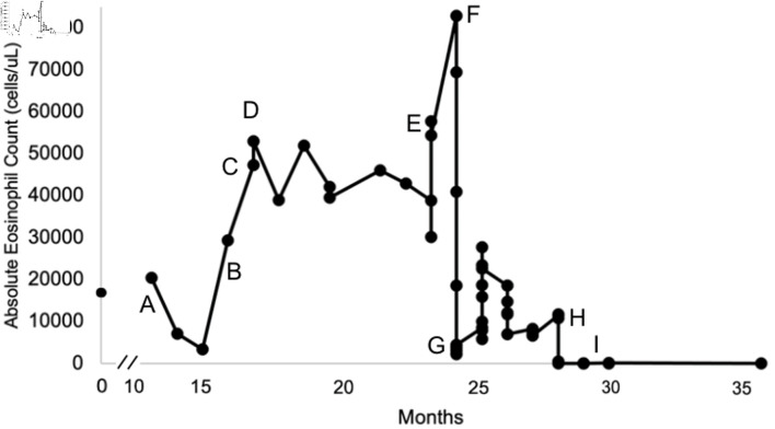Benralizumab in a Patient With Refractory Eosinophilic Endocarditis.