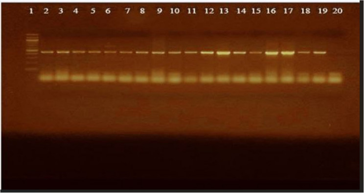 Detection and antimicrobial susceptibility of E. coli O157:H7 in the milk supply chain, milking environments and humans in Woliata Sodo, Ethiopia.