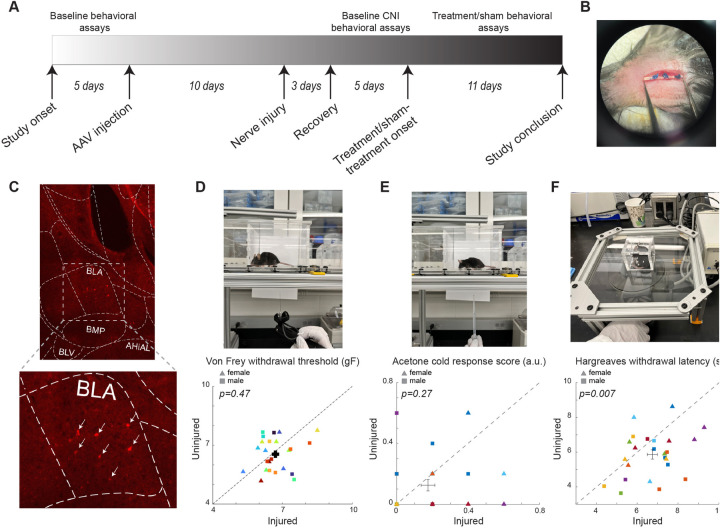 Bidirectional modulation of somatostatin-expressing interneurons in the basolateral amygdala reduces neuropathic pain perception in mice.