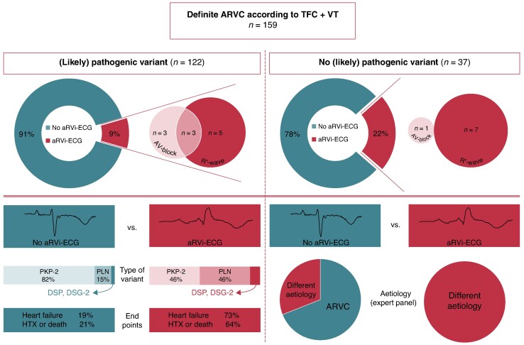 Different underlying aetiologies in patients presenting with ventricular tachycardia fulfilling task force criteria for arrhythmogenic right ventricular cardiomyopathy: initial suspicion based on the 12-lead electrocardiogram.