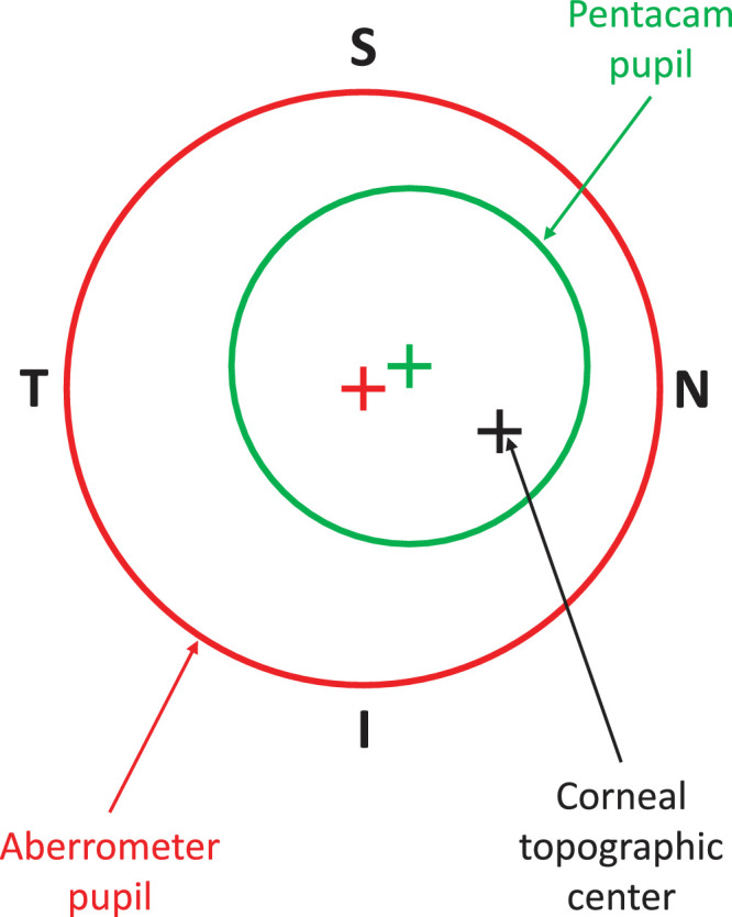 Contribution and Compensation Effects of Refracting Components to Ocular Aberrations in Keratoconus.