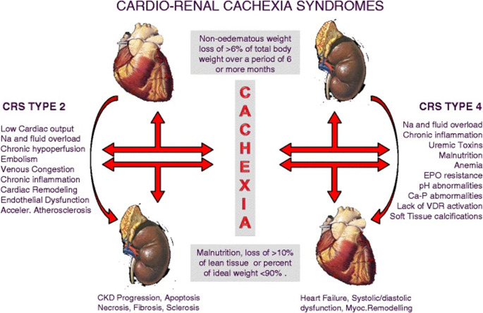 When the Heart, Kidneys, and Body Waste Away: A Review of Cachexia in Cardiorenal Syndrome.