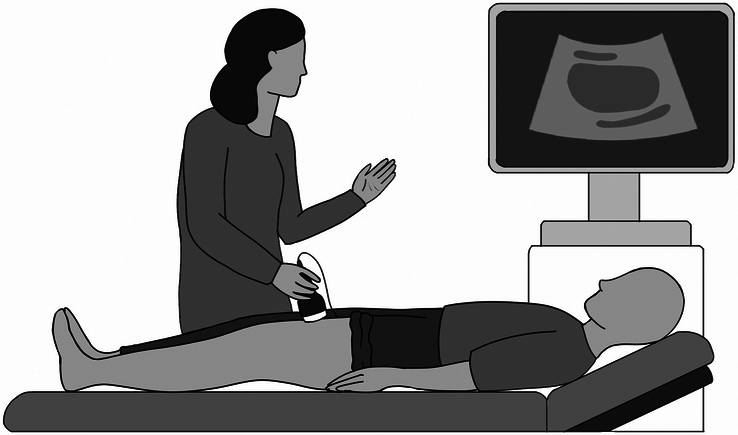 Ultrasound of the rectus femoris as a novel tool to measure sarcopenia in pediatric chronic liver disease.