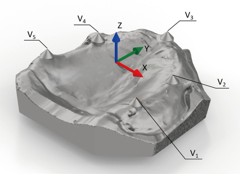 Occlusal teeth surface accuracy of milled complete dentures: a comparison between different manufacturing techniques.