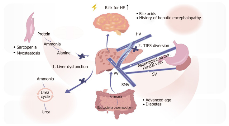 Risk factors for hepatic encephalopathy after transjugular intrahepatic portosystemic shunt in cirrhotic patients: A comprehensive minireview.