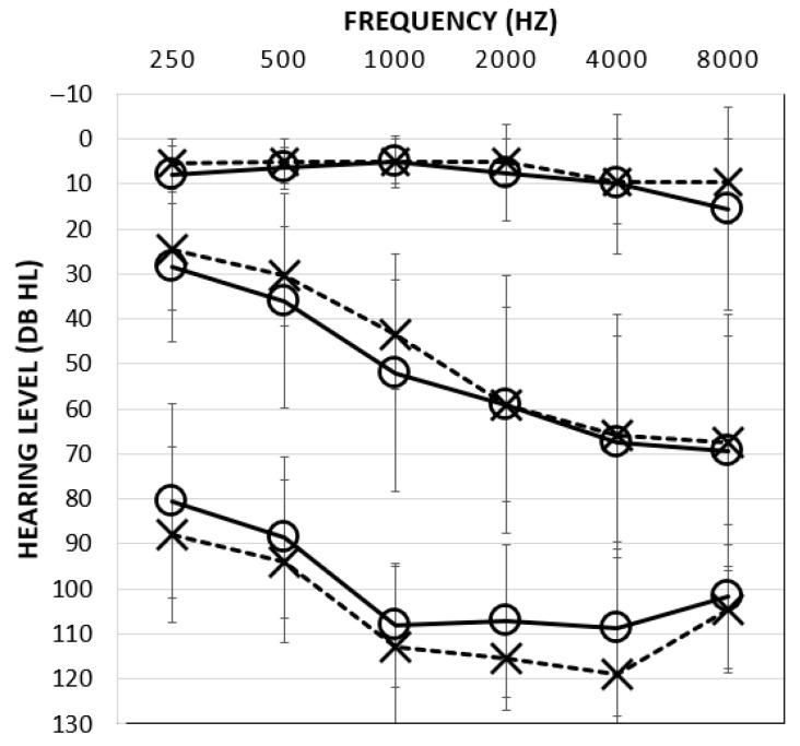 Comparison of Prototype Transparent Mask, Opaque Mask, and No Mask on Speech Understanding in Noise.