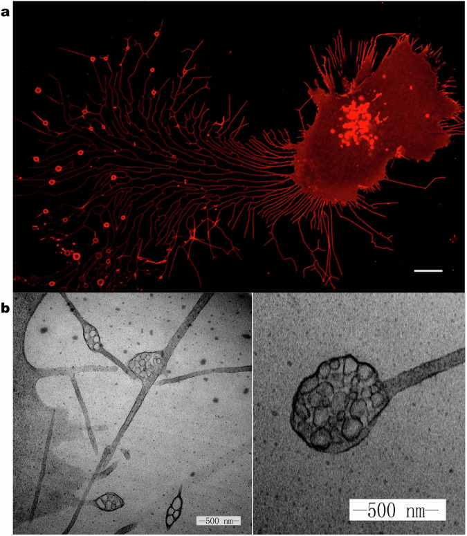 Biogenesis, functional roles, and pathological implications of migrasomes.
