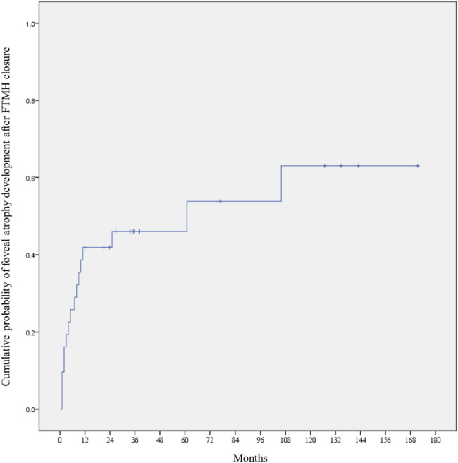Long-term surgical outcome of high myopic full-thickness macular hole without retinoschisis.