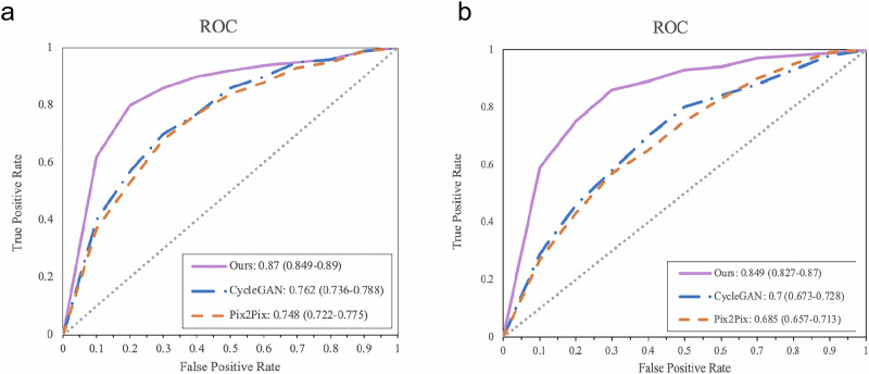 Forecasting the diabetic retinopathy progression using generative adversarial networks.