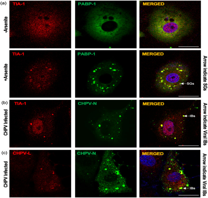Participation of host cell proteins in inclusion bodies of non-segmented RNA virus infected cells: a molecular insight.