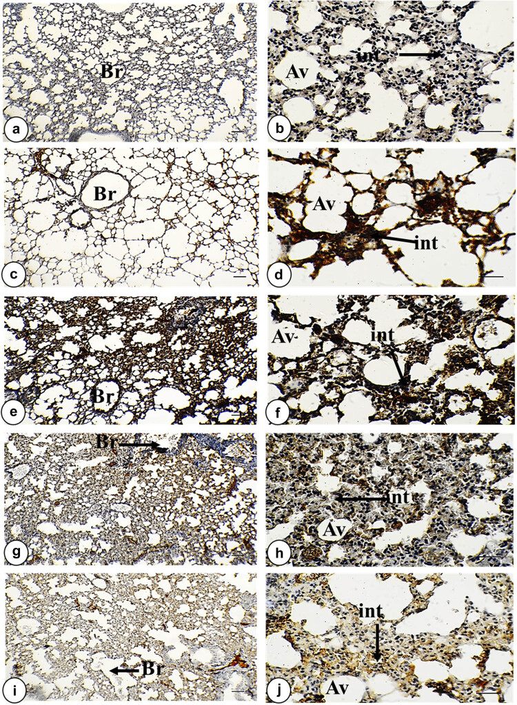 Morphometric analysis and immunobiological investigation of <i>Indigofera oblongifolia</i> on the infected lung with <i>Plasmodium chabaudi</i>.