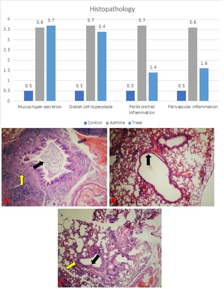 Investigating the effect of Ranolazine drug on the pathophysiology of asthma in a rat model.