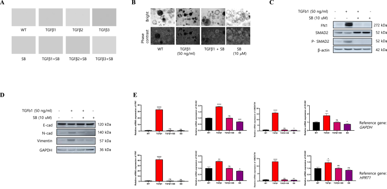 3D alveolar organoid drug screening model for targeting TGF-β1 in pulmonary fibrosis.