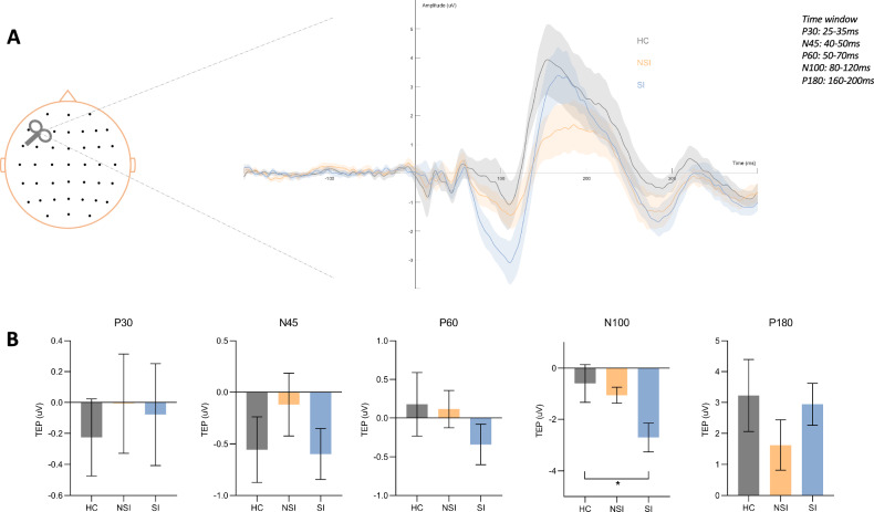 Heightened effective connectivity of DLPFC-mPFC and DLPFC-ACC circuits in major depressive disorder with suicidal ideation: evidence from a TMS-EEG study.